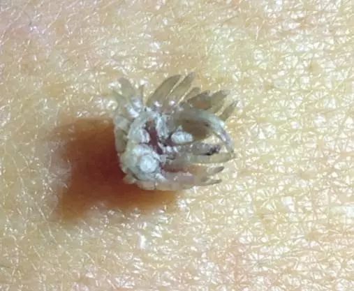 密恐慎入,密恐患者慎入的危害