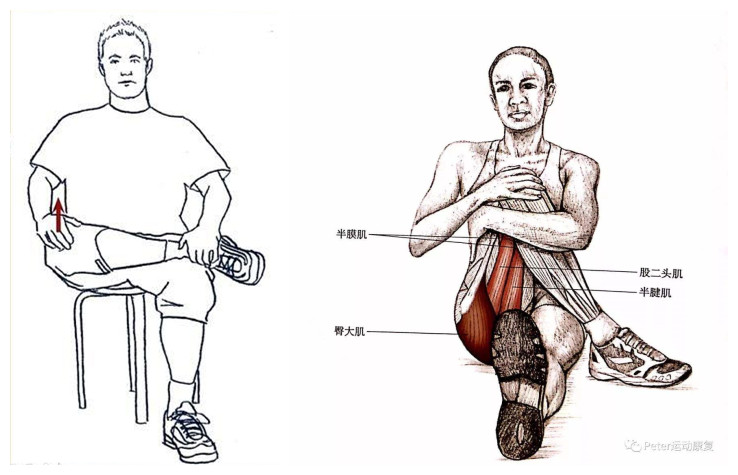 屁股痛、腿麻，有块肌肉受伤了