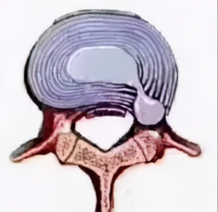腰腿痛病因病机是什么,腰腿痛的病因全在这里了