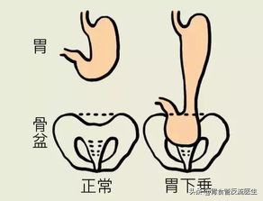 生活习惯对肠胃的危害,哪些生活习惯会对胃造成伤害