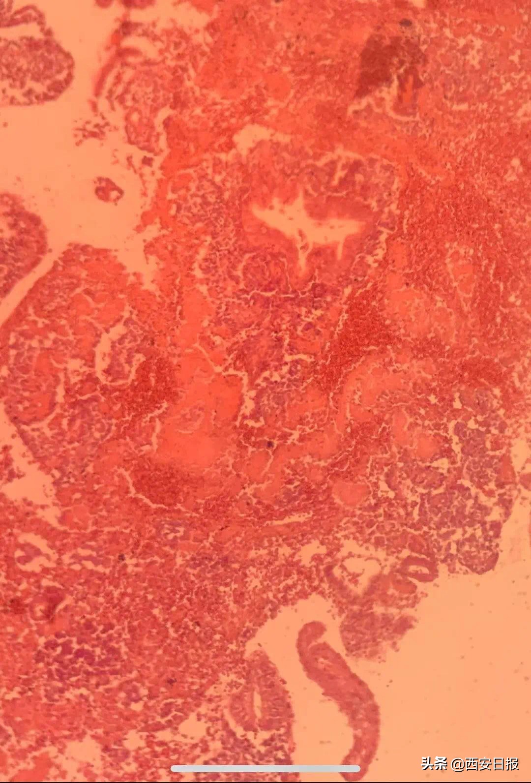 病理学切片染色,病理技术常规切片染色