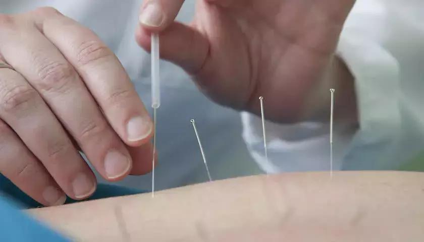 中国针灸进入美国医保,老干妈马应龙最新视频