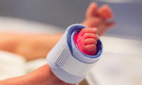 3.7斤早产儿终于长大了,早产儿从3.5斤长到4斤大概要好久