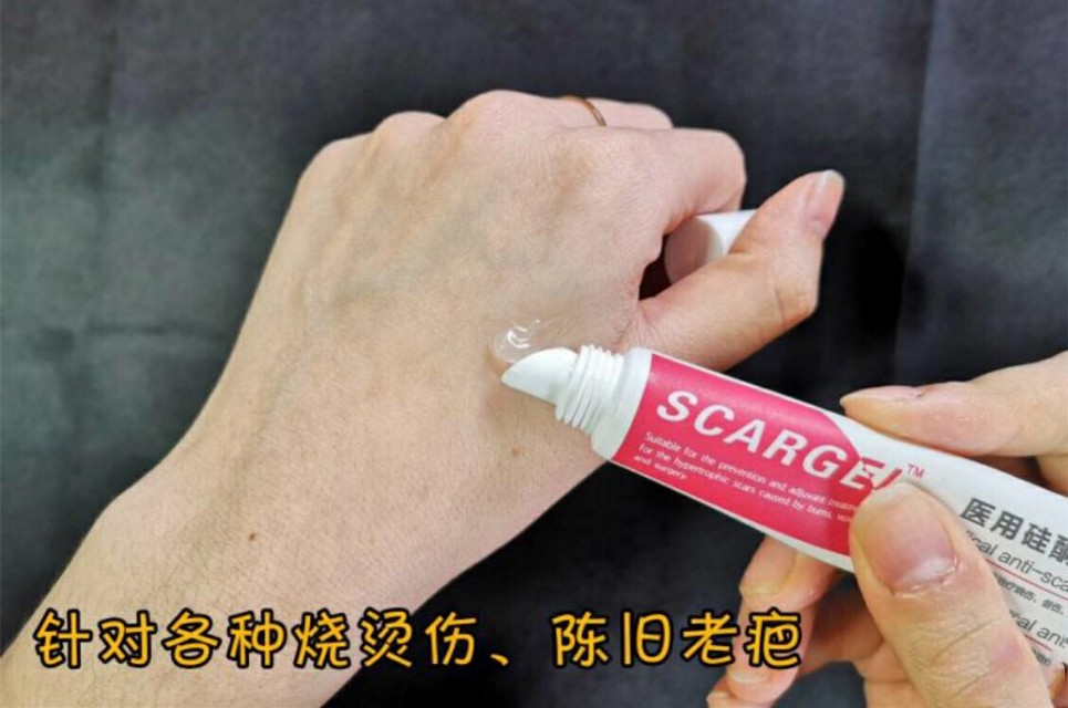 超实用常见皮肤问题护理方法分享,皮肤问题手把手教你解决