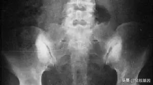 产后妈妈十大疼痛,哪一个你中招了?