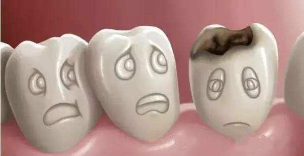 补牙后注意事项与禁忌,补牙如何减缓疼痛感