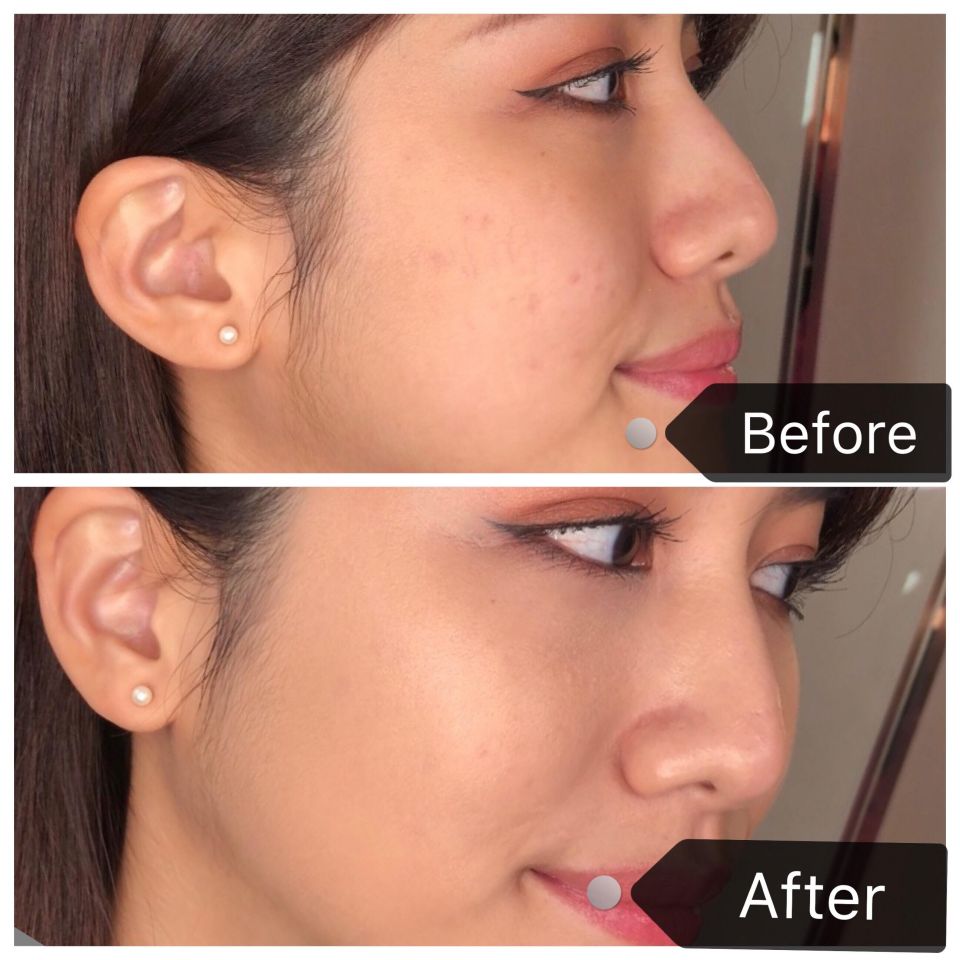 夏季和冬季都适合的粉底液,适合换季的粉底液