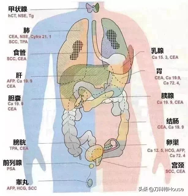 怎样看懂女性肿瘤标志物全套报告,各种常见肿瘤的早期检查方法