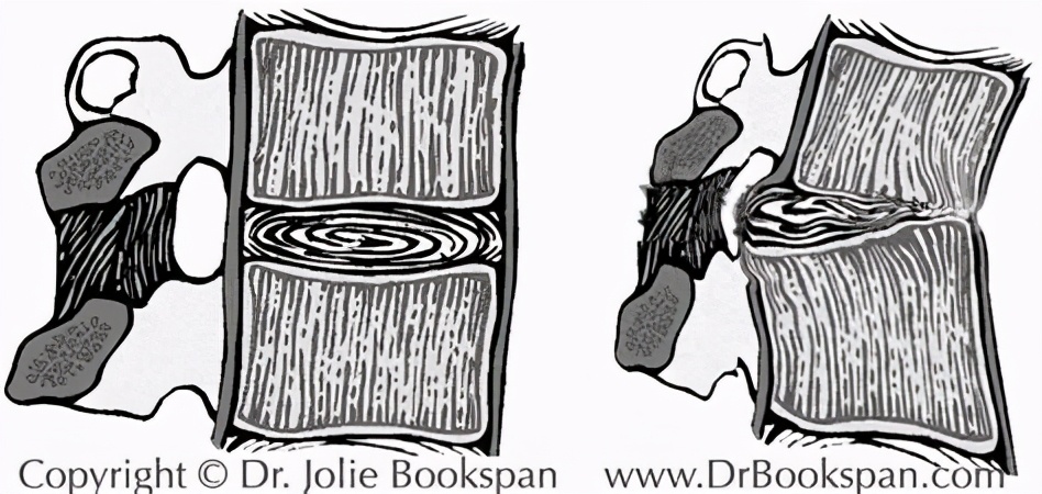 脚底疼痛警惕四种病小腿,脚底面部疼痛预示十种疾病