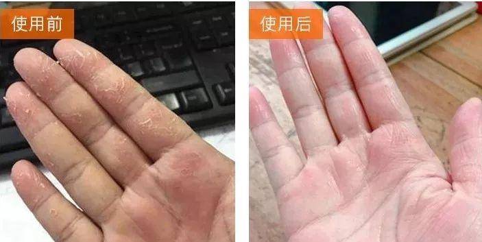 片仔癀紧致抗皱补水提亮水乳,片仔癀适合干性皮肤的面霜