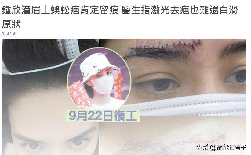 阿娇额头伤口恢复过程,阿娇晒伤口恢复照