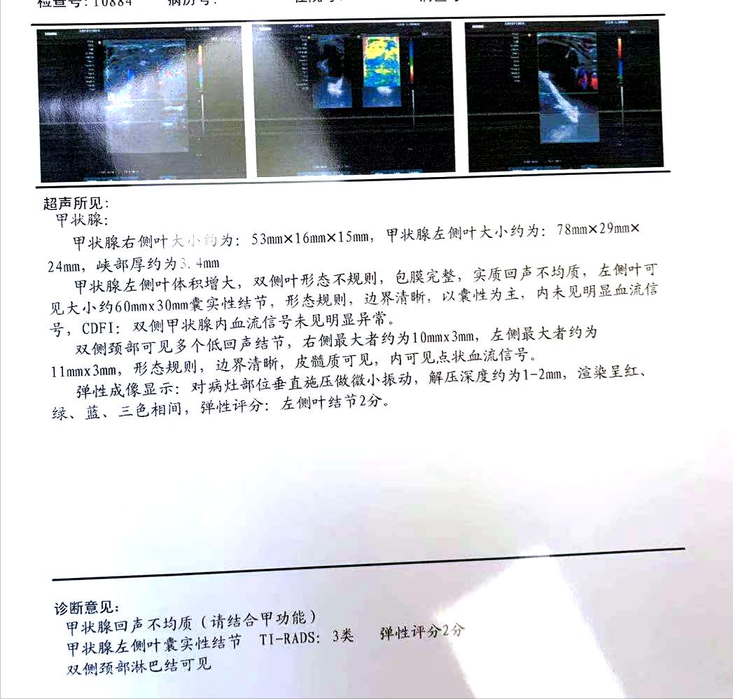 甲状腺结节从18mm一年长到23mm,一年内长出2mm甲状腺结节