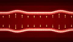 高血压的人怎样预防中风,高血压预防中风首选哪种药