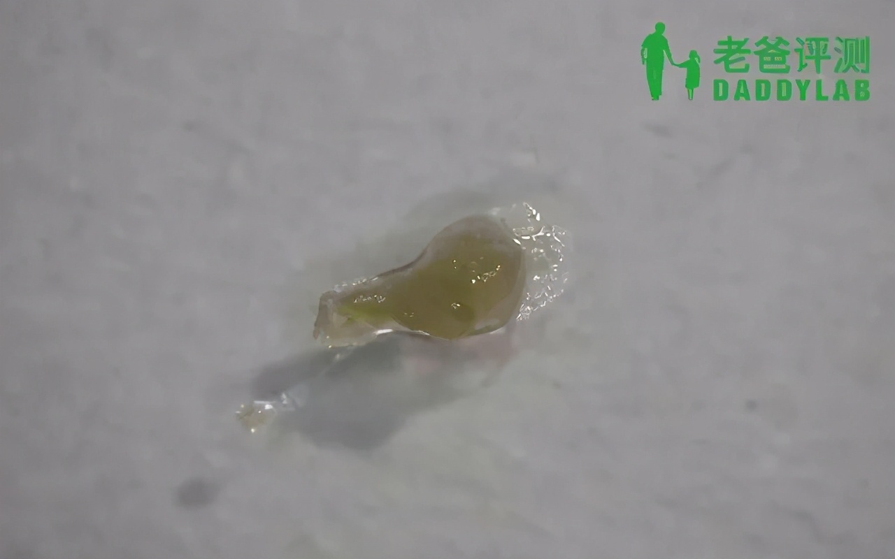 黑头怎么从根部去除,黑头到底怎么去