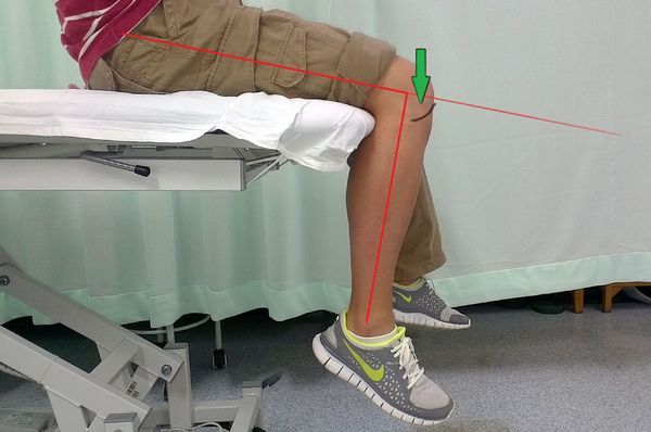 滑膜炎导致腿伸不直怎么治疗,腿伸不直也蹲不下去是什么原因