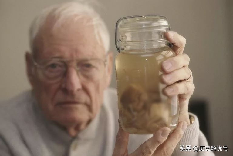 爱因斯坦遗言解剖大脑,爱因斯坦去世后大脑解剖