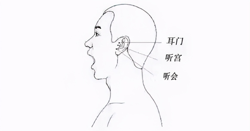耳鸣也是一种警报,耳鸣意味着你可能得了这些病