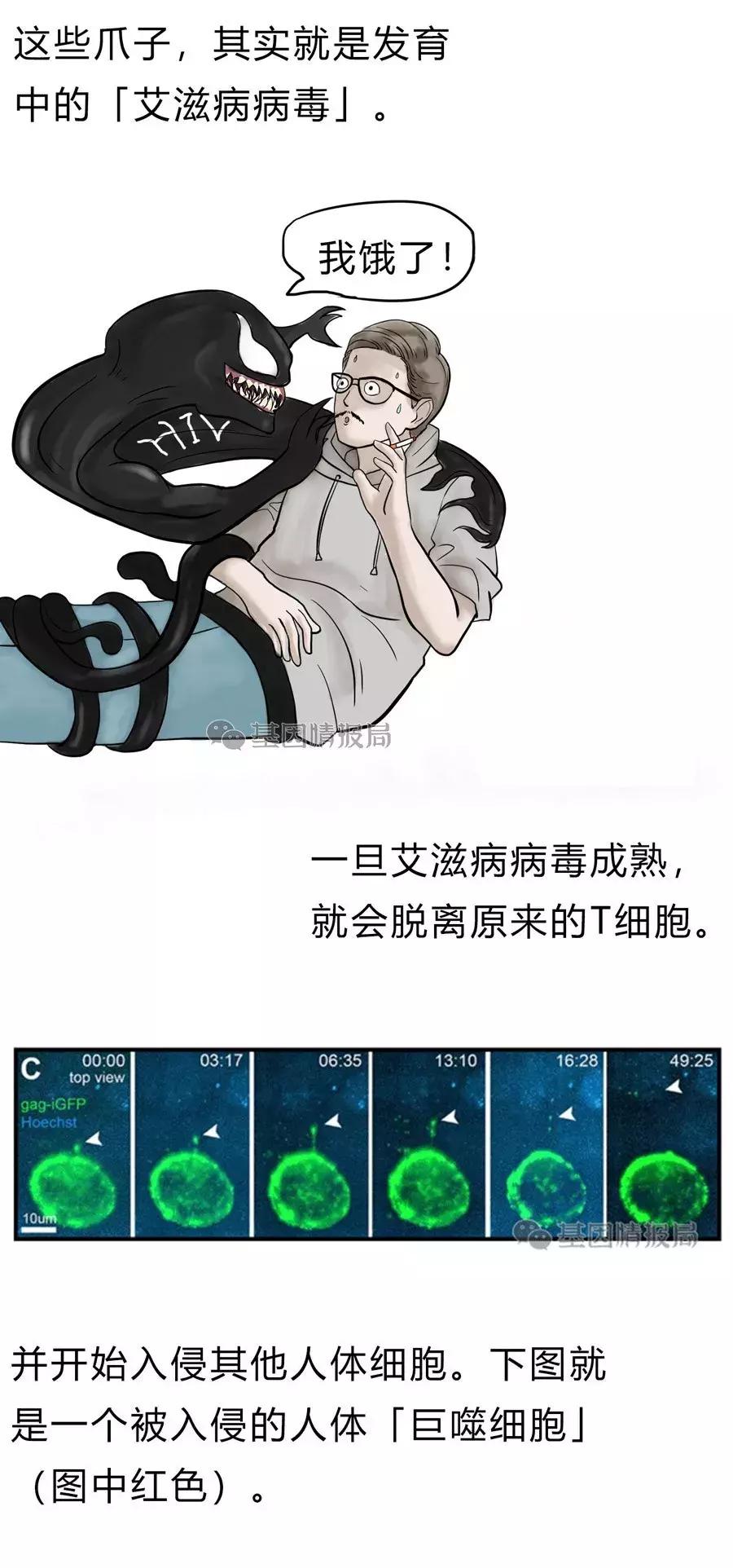 艾滋病病毒入侵全过程曝光,世界上被证实的艾滋病毒体外感染