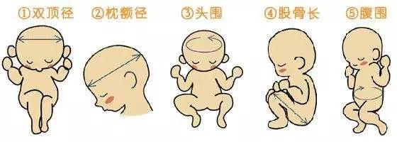 股骨偏小是胎儿生长受限吗,胎儿股骨长68是小短腿吗