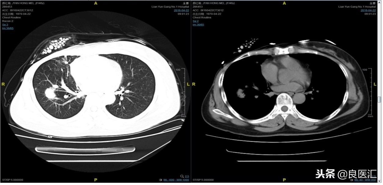 美图秀秀成功案例,美图秀秀实战案例