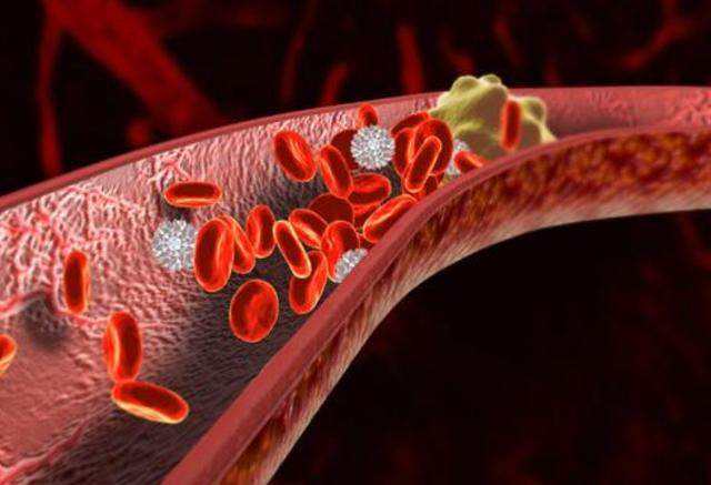 新冠病毒症状早期表现会不会尿频,新冠病毒的并发症状