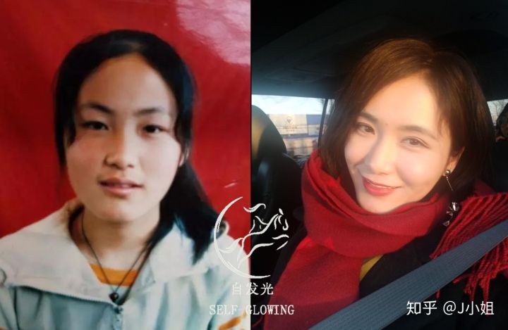 鱼尾纹法令纹还有什么纹,法令纹鱼尾纹一般什么年龄段出来