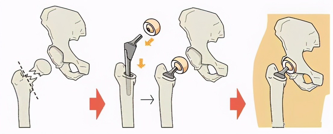 上海长征医院王波医生介绍,上海长征医院王波简介