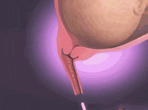 孕妇胎儿动图,3d动图视频怎么做