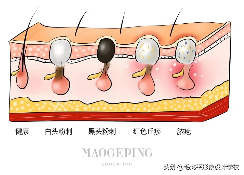 有哪些别人信以为真的护肤谣言,越来越丑的十大护肤谣言