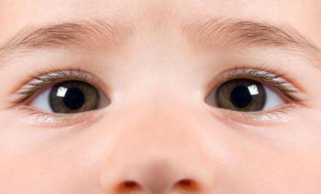 刚满月的宝宝眼睛有黄色眼屎咋办,刚满月宝宝眼睛有一只不一样大