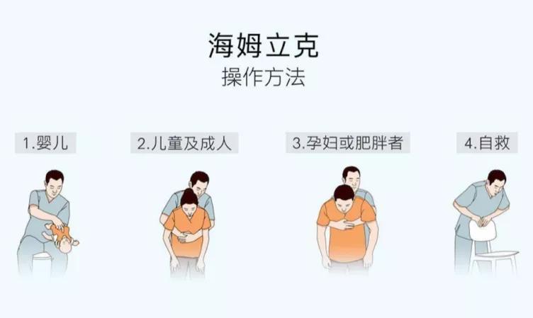 气管呛入异物最佳处理方法,呛住气管异物怎么自救