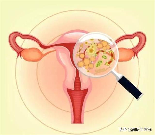 17岁女生，为了抗病毒一次性*裤内**每天换，遭到医生吓止：没必要