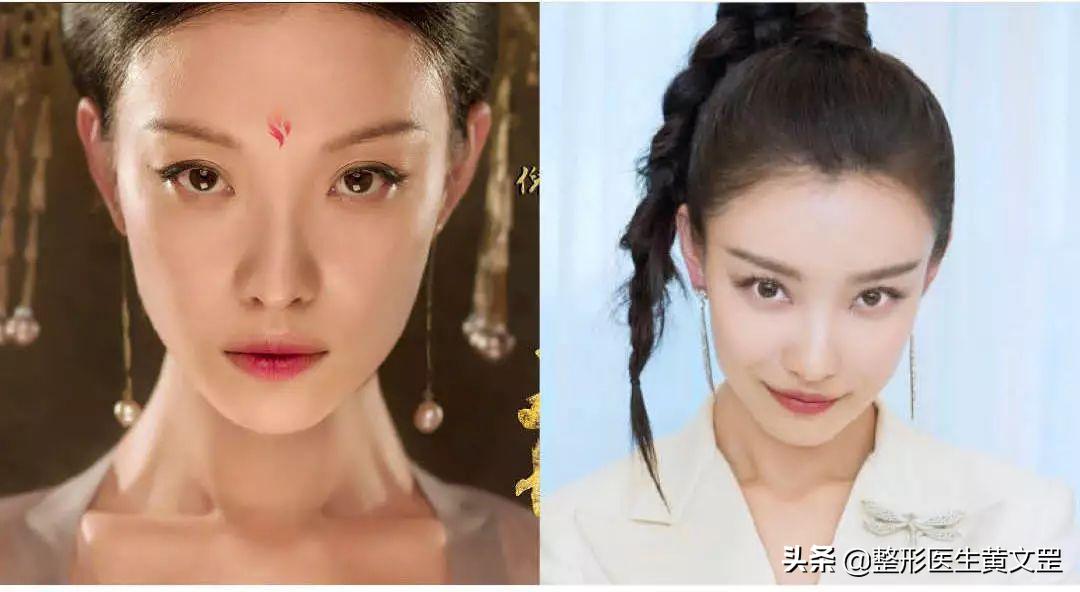 大小眼双眼皮能做眼综合手术吗,眼综合双眼皮全切