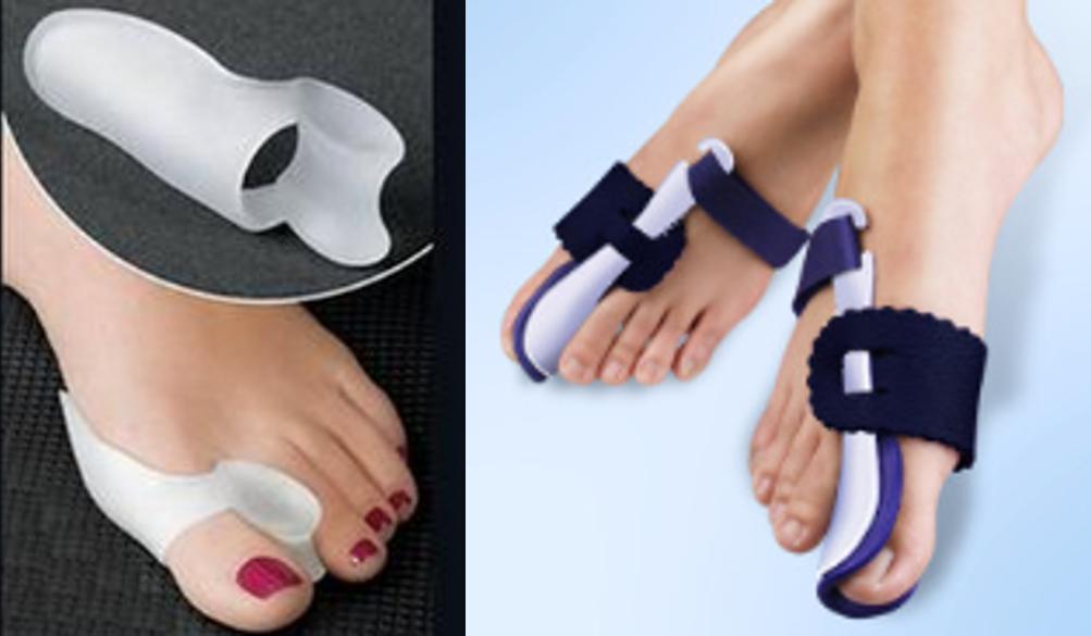 中老年女性拇外翻能矫正过来吗,女性脚拇指外翻原因