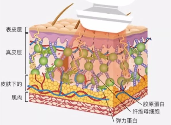 雅萌到底该怎么选,新手买雅萌哪款合适