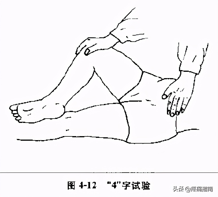 夏天无注射液能治疗骨头坏死吗,骨头坏死用针刀镜有用么