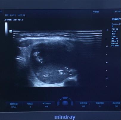 手术根治能彻底治愈吗,手术做不好怎么处理