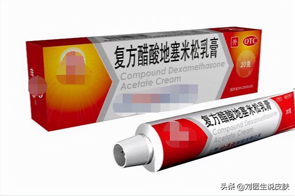 误把股癣当湿疹,错把特应性皮炎当湿疹治