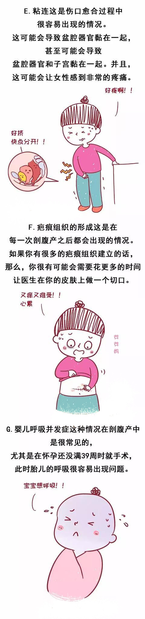 女人生孩子理所应当？女人一生最多能承受几次剖腹产，你知道吗？