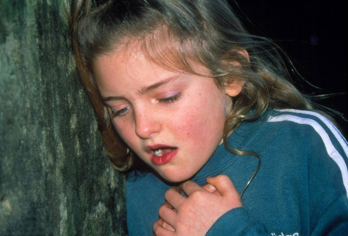 小孩发烧致脑膜炎可以治好吗,儿童发热脑膜炎症状