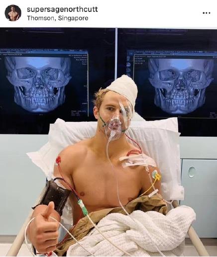 太狠了！一拳下去竟然碎了8块脸骨！