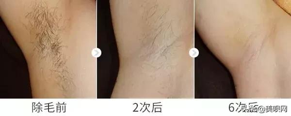 雪莉雀斑妆视频,雪莉伪素颜妆