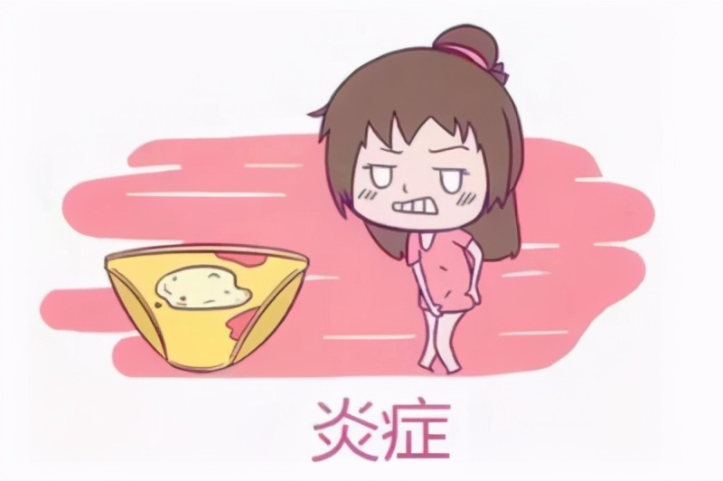 妇科检查与常用的辅助检查知识点,四个妇科知识