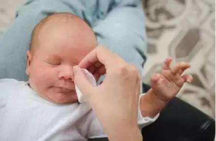 宝宝眼屎多并非都是上火惹的祸！这几种情况需要就医