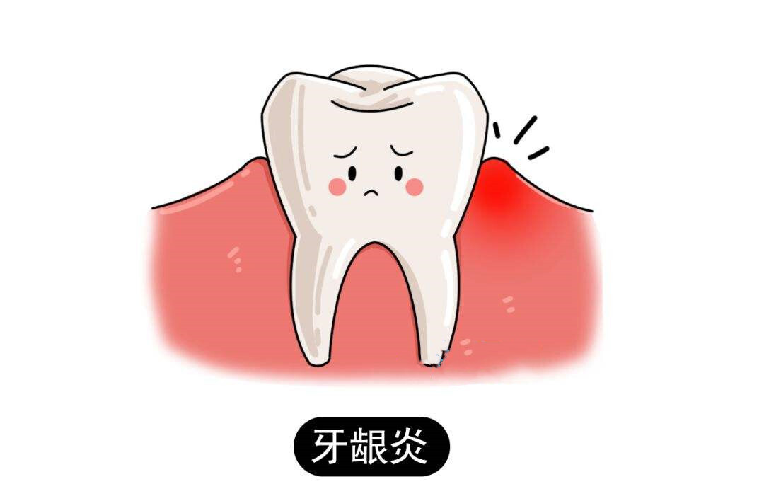 肝硬化的牙龈出血和牙龈炎的区别,牙龈出血牙龈炎验方