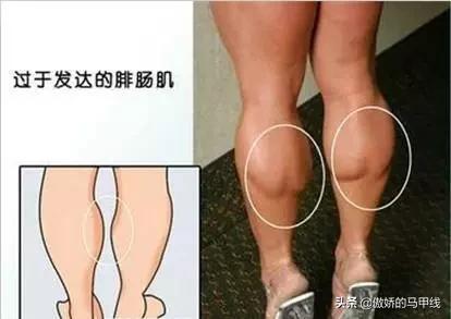 跳绳和跑步哪个会让小腿变粗,运动小腿越来越粗壮