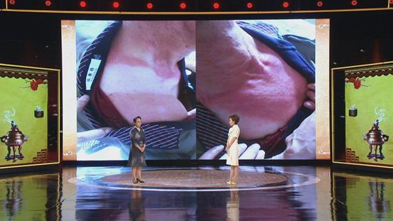 北京中医郭玉琴医生咋样,郭玉琴中医讲座