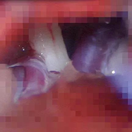 天下第一痛,什么是天下第一痛