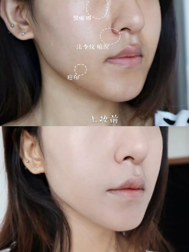 毛戈平粉膏痘坑肌上妆效果,毛戈平粉膏瑕疵皮真实测评