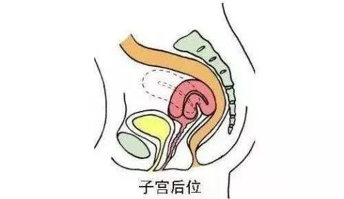 子宫后位怎么快速怀孕,子宫后位的人是不是不太容易怀孕